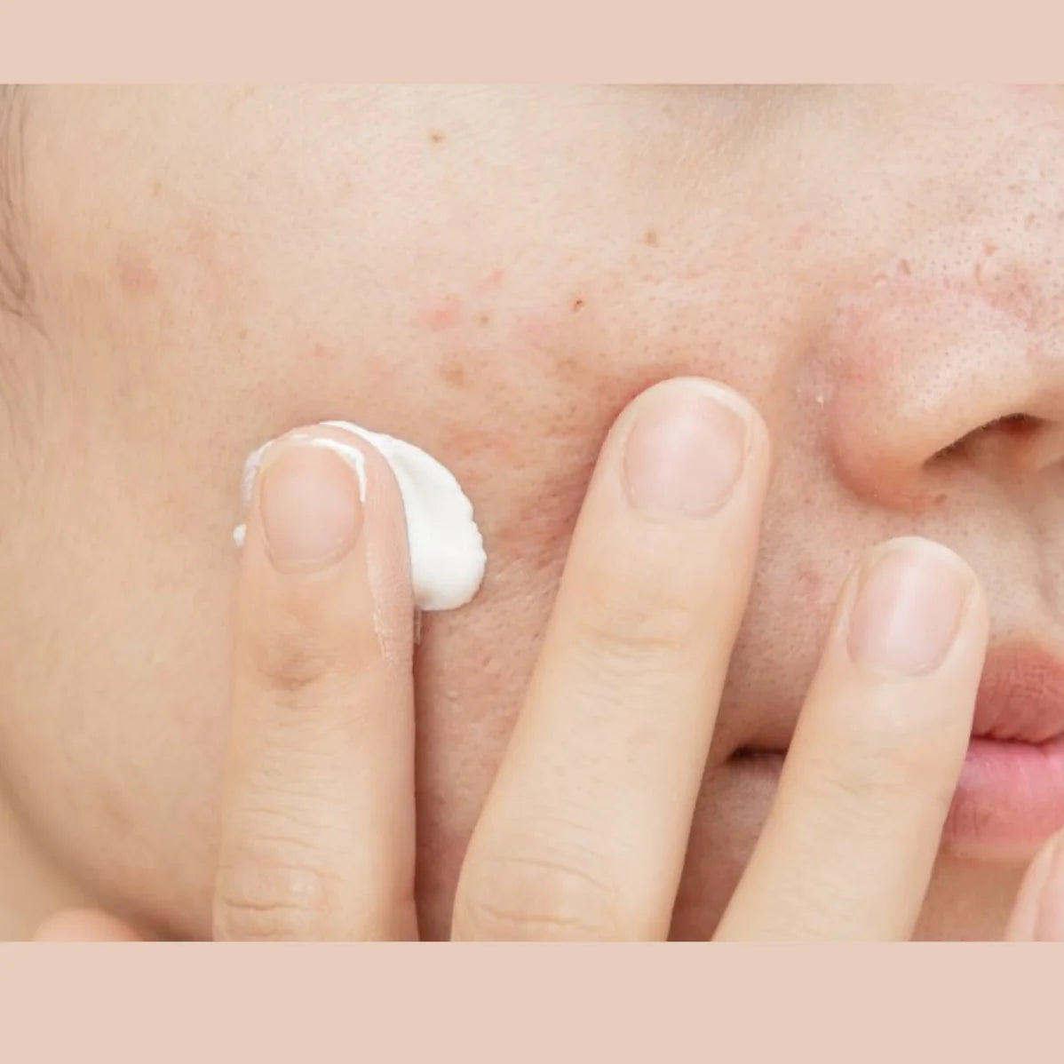 Breakout Control Daily Moisturizer